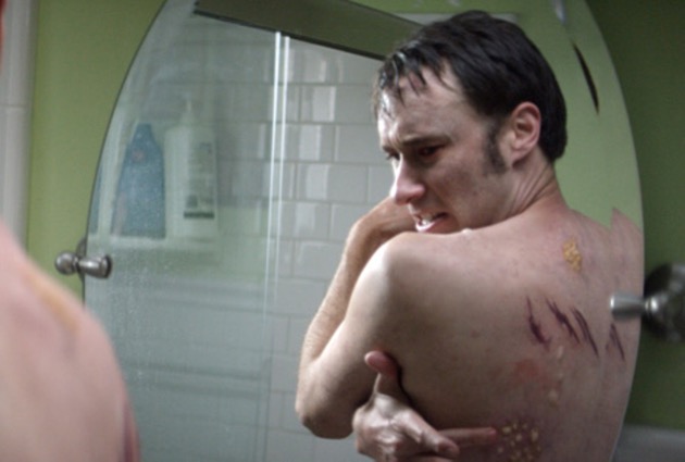 Contracted: Phase II